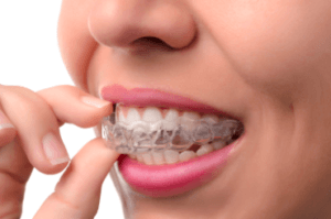 girl with Invisalign tray smiling